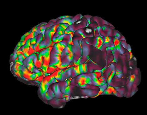 Что показывает мрт головного мозга?
