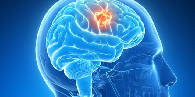 Болезни головного мозга и головы: список названий, симптомы