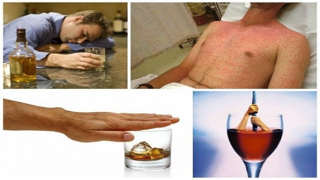 Аллергия на алкоголь: симптомы, фото и лечение