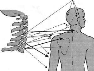Болит шея и затылок: причины и лечение