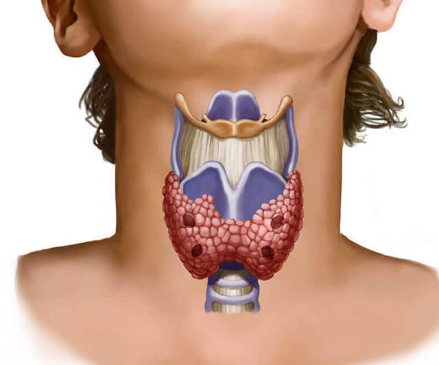 Жжение в шее, что это может быть? Может ли болеть щитовидная железа у мужчин и женщин