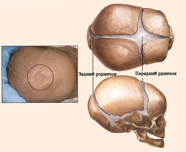 Метопический шов: описание с фото, причины проявления, симптомы, диагностика и рекомендации врачей