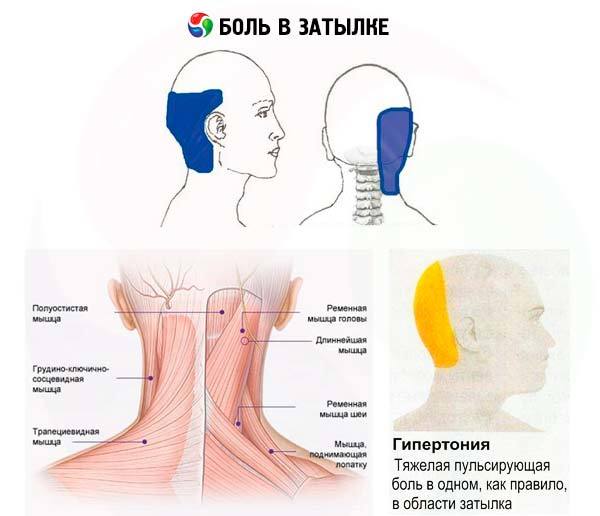 Пульсирующая боль в голове и затылке (сильная, резкая): причины, лечение