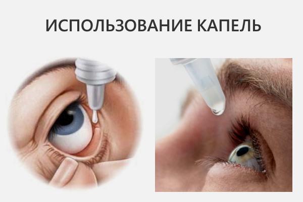 Глазное давление: как и чем лечить?