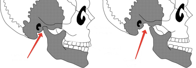 Болит челюсть возле уха при жевании: почему