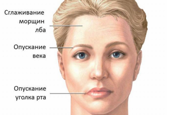 Лицевые боли: лечение невралгии тройничного нерва