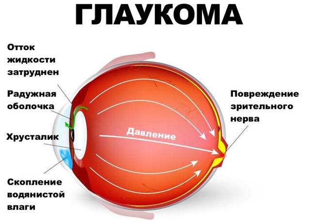 Болит глазное яблоко при движении - боль в глазах, причины, почему при повороте в глазу, при надавливании