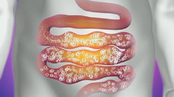 Газообразование в кишечнике: причины появления и лечение