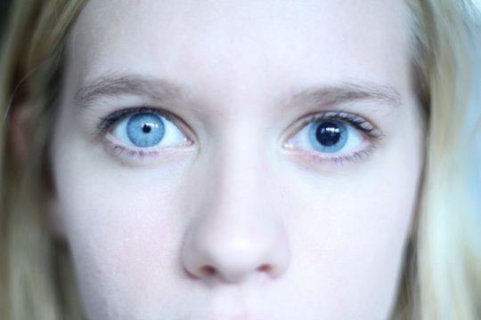 Один зрачок (один глаз) больше другого - причины у взрослых, лечение и профилактика