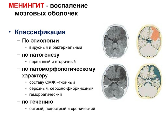 Болезни головного мозга и головы: список названий, симптомы