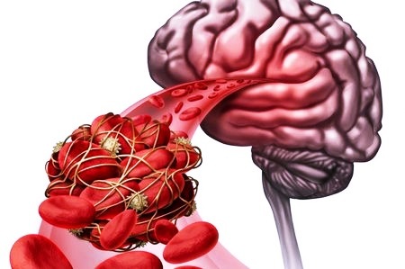 Поражение головного мозга: причины и симптомы нарушения