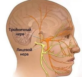 Неврит лицевого нерва - симптомы, лечение, причины болезни, первые признаки