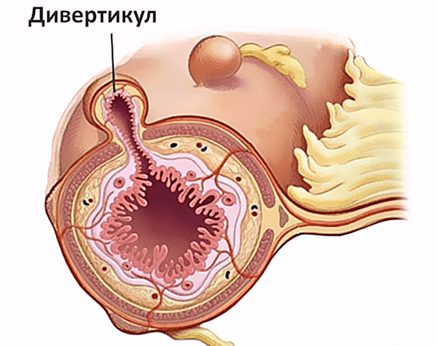 КТ кишечника – подготовка к процедуре, что показывает исследование