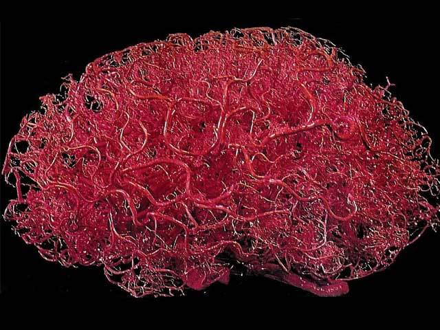 Сосуды головного мозга: симптомы и лечение, народные средства, как почистить?