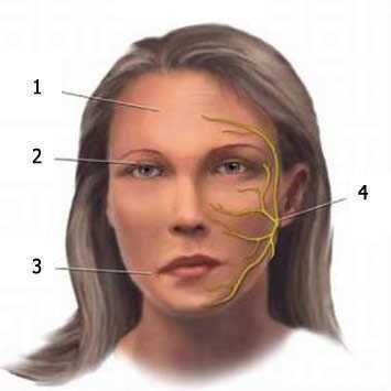 Неврит лицевого нерва - симптомы, лечение, причины болезни, первые признаки
