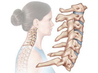 Боль в шее при повороте головы (резкая, острая): причины и лечение