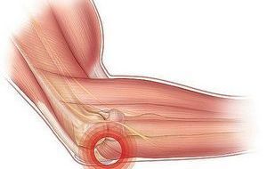 Слабость в ногах при остеохондрозе: причины и лечение