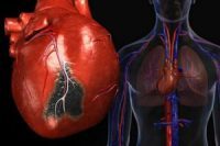 Сердце стучит в горле (ощущение сердцебиения) — что это, причины и лечение симптома