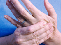 Покалывание в руках: причины, симптомы и лечение