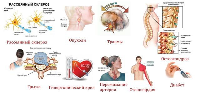 Немеет голова: причины и особенности лечения