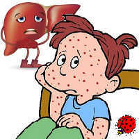 Сыпь при гепатите
