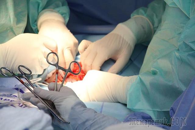 Киста поджелудочной железы - можно ли обойтись без операции?