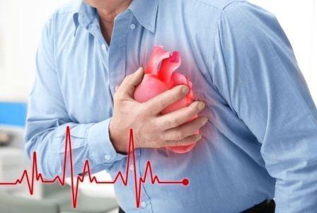 Отличие инсульта от инфаркта: в чем разница и что общего
