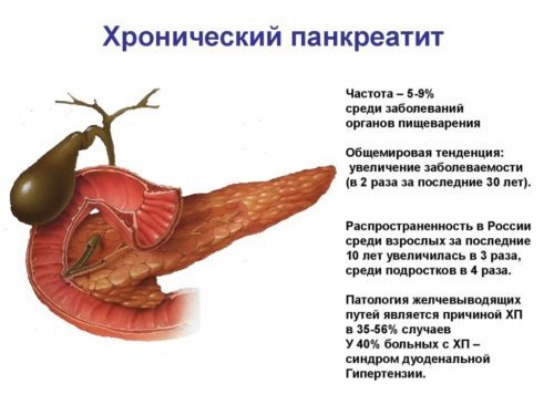 Как лечить поджелудочную железу: симптомы и советы врача, как питаться при панкреатите