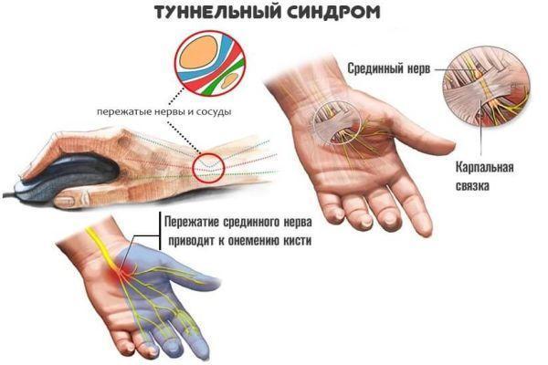 Стреляющая боль в голове: причины и лечение