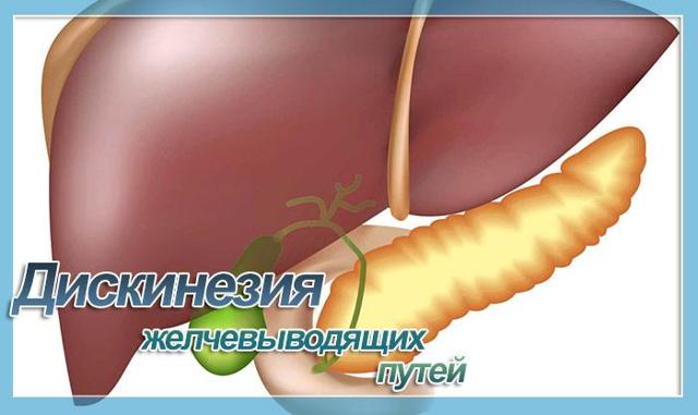 МКБ-10 Дискинезия желчного пузыря и желчных путей - лечение, клиника, признаки по международной классификация болезней