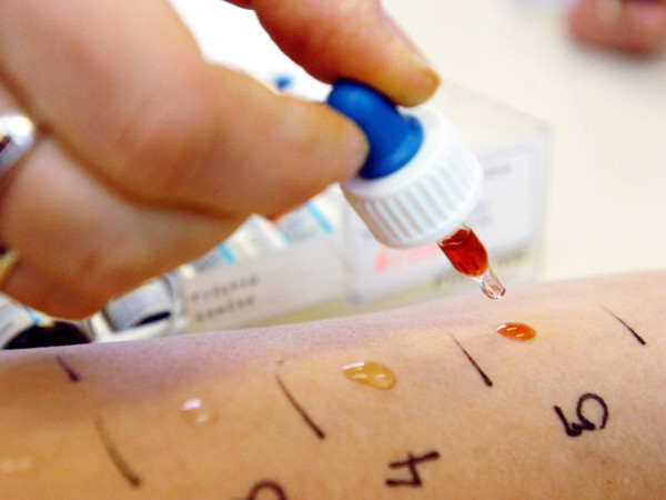 Анализ крови на аллергены: показатели и расшифровка