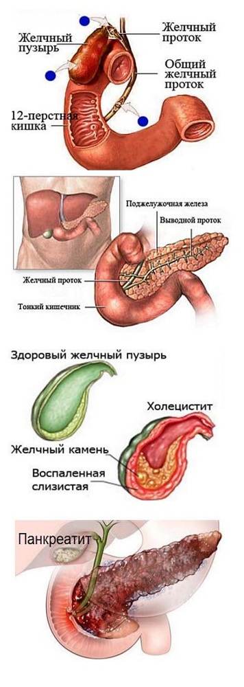 Как лечить поджелудочную железу: симптомы и советы врача, как питаться при панкреатите