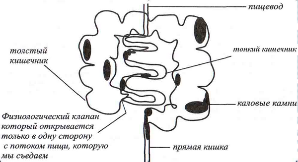 Каловые массы в кишечнике фото