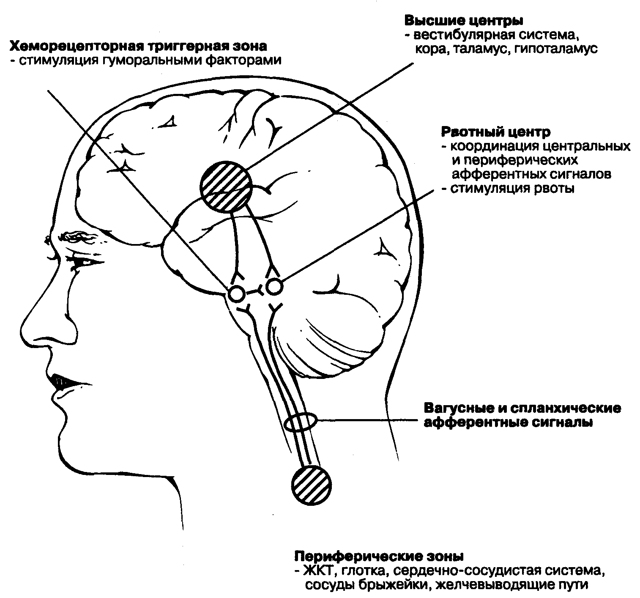 По утрам тошнота: причины и лечение