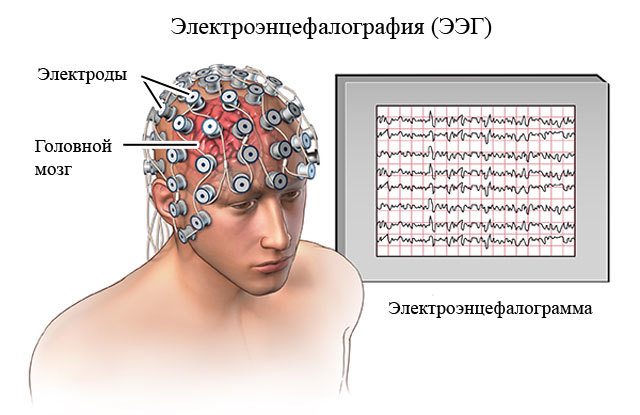 Признаки эпилепсии у детей до года: причины, виды симптомов, в чем опасность