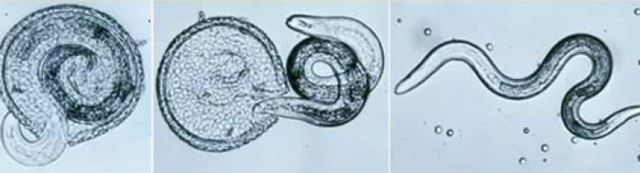 Токсокароз лечение у человека