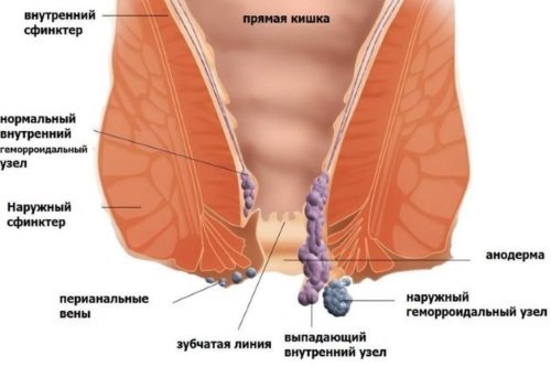 Боль в прямой кишке болезни симптомы диагностика лечение профилактика рекомендации