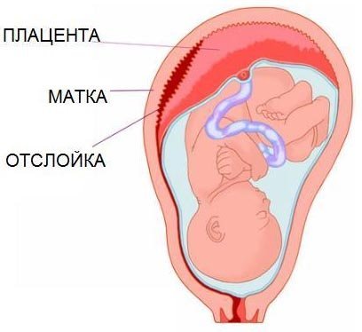 О чем говорят выделения при беременности на ранних и поздних сроках? Какие выделения при беременности считаются нормой?