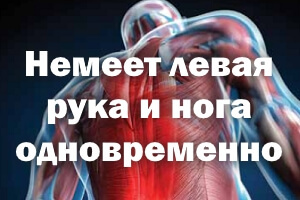 Немеет левая рука