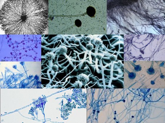 Нити мицелия в организме человека - как обнаружить патогенный грибок, медикаментозная и народная терапия
