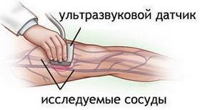 Немеет левая нога: причины и лечение недуга