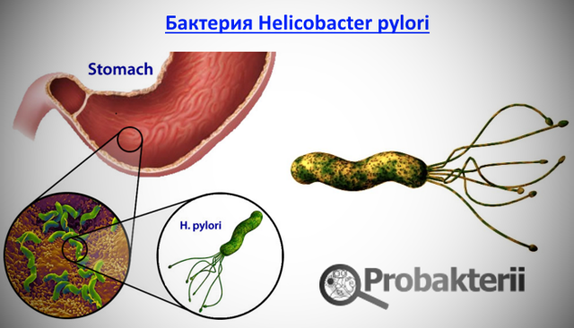 Лечение хеликобактер пилори прополисом: рецепты