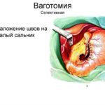 Гастрин что это такое и за что отвечает этот гормон