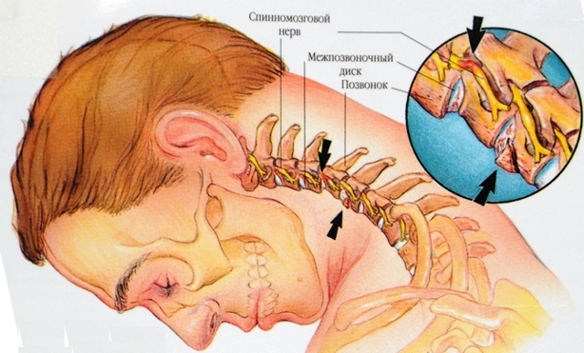 Болит голова при наклоне вниз: причины, лечение