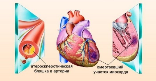 Резкое падение артериального давления причины