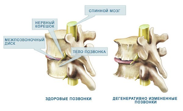 Боль в шее с правой стороны: причины, диагностика, лечение