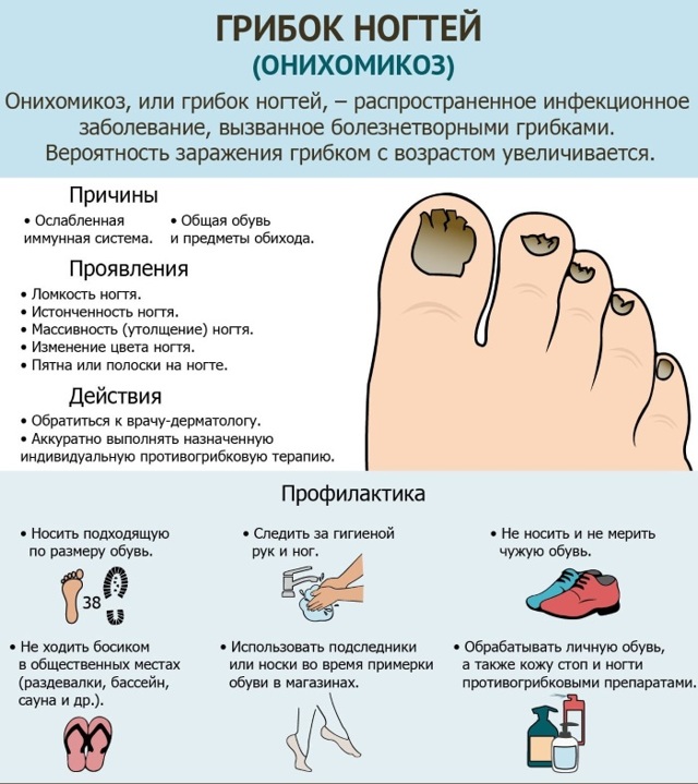 Как лечить грибок между пальцами ног: аптечные мази и кремы