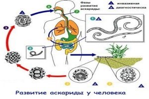 Тонкий кишечник человека, основные заболевания и симптомы