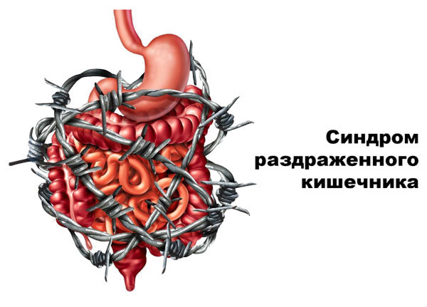 Диета при раздраженном кишечнике с болевым синдромом: продукты питания при СРК