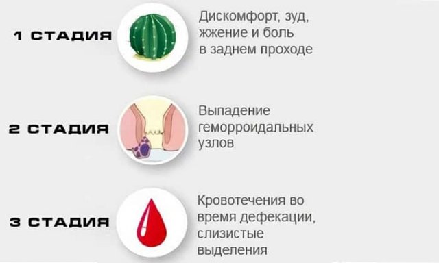 Мазь Вишневского при геморрое, парапроктите и трещинах — как применять и мазать